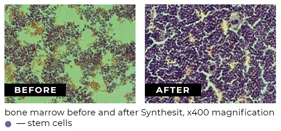 Number of stem cells in bone marrow before and after taking Synthesit